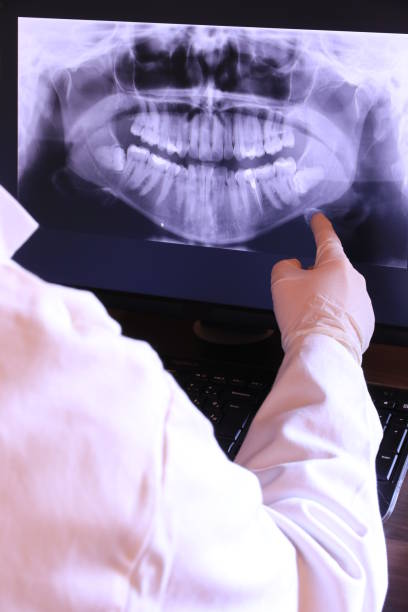 Best Chipped Tooth Repair Near Me  in Bryant, AR