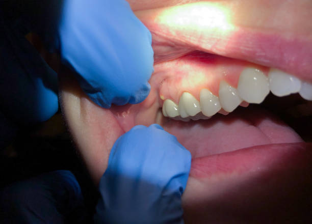 Urgent Tooth Repair in AR